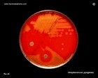 penicillin susceptible GAS